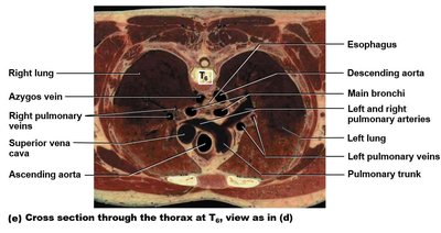 Cross section through the thorax at T6, showing anatomical relationships of lungs, heart, and vessels