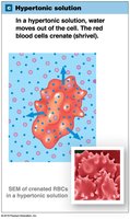 Hypertonic Solution