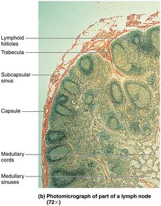 Photomicrograph of part of a lymph node
