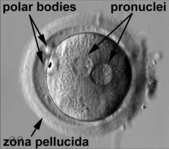 Oocyte with polar bodies, pronuclei, and zona pellucida