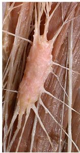 Gross structure of the spleen
