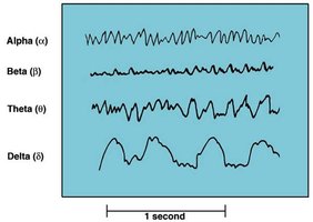 EEG tracings of alpha, beta, theta, and delta waves