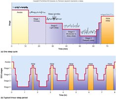 Graph showing sleep stages and REM cycles