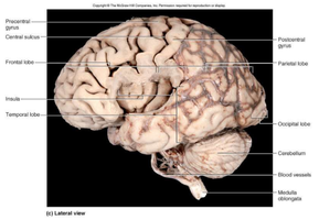 Dissected brain showing the insula