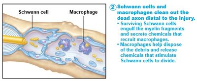 Schwann cells and macrophages clean out the dead axon distal to the injury
