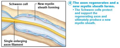 The axon regenerates and a new myelin sheath forms
