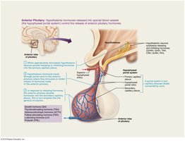 Diagram comparing Type 1 and Type 2 diabetes mellitus