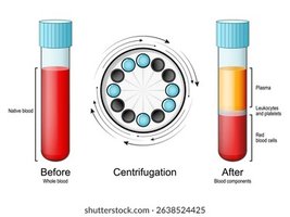 Centrifugation of blood showing separation into plasma, leukocytes/platelets, and red blood cells
