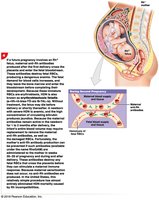 HDN: Effects in future pregnancies