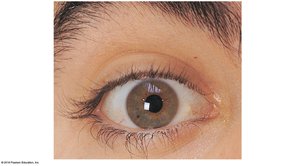Surface anatomy of the eye and accessory structures