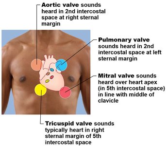 Auscultation locations for heart valves
