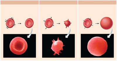 Tonicity effects on red blood cells