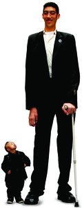 Disorders of pituitary growth hormone: gigantism and dwarfism