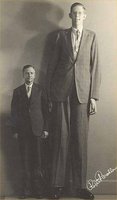 Gigantism due to GH hypersecretion