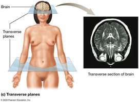 Transverse plane