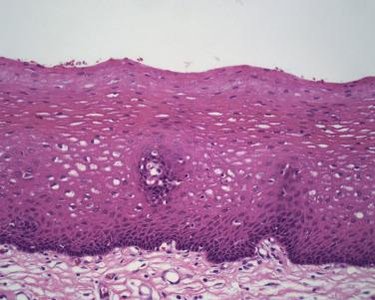 Stratified squamous epithelium under microscope