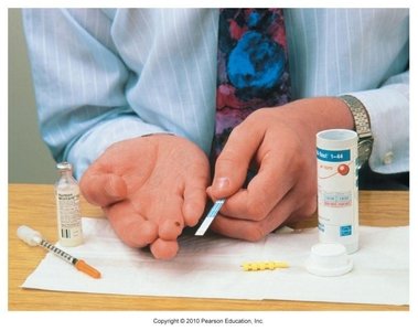 Blood glucose monitoring and insulin injection