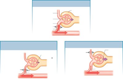 Effects of arteriole resistance on GFR