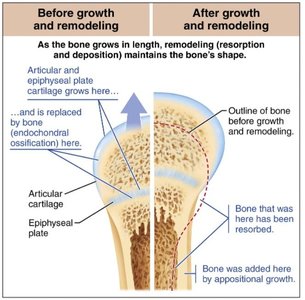 Bone growth and remodeling before and after