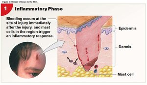 Inflammatory phase of skin repair
