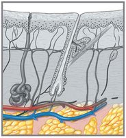 Third-degree burn (full-thickness)