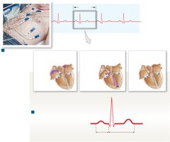 Electrocardiogram