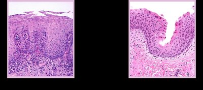 Stratified squamous and transitional epithelium
