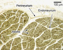 Microscopic view of nerve cross-section