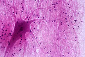 Multipolar motor neurons in spinal cord