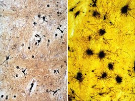 Microglia and astrocytes in CNS