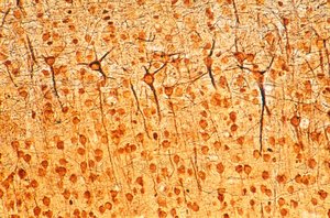 Pyramidal cells in cerebrum