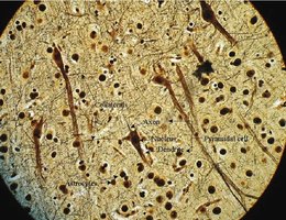 Nerve cross-section with myelinated and nonmyelinated axons