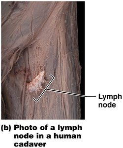 Photo of a lymph node in a human cadaver