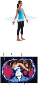 Transverse plane and MRI scan