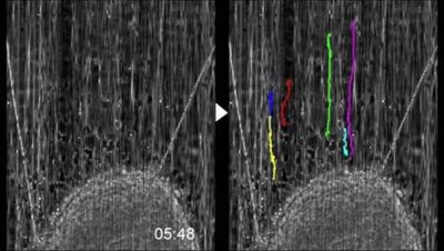 Somal translocation during migration