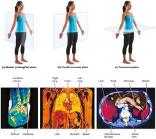 Planes of the body with corresponding MRI scans
