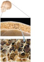 Spongy bone (diploë) and trabeculae