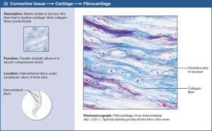 Photomicrograph of fibrocartilage