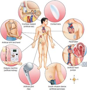 Examples of prosthetic and artificial organs
