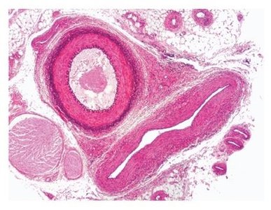 Histological section of artery and vein