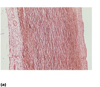 Elastic artery wall structure