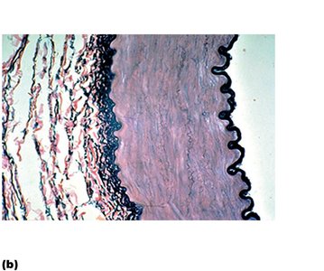 Muscular artery wall structure