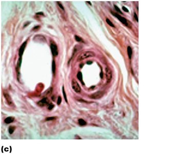 Arteriole wall structure