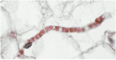 Red blood cells passing through a capillary