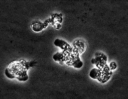 Naegleria fowleri, a pathogenic amoeba