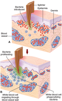 Typical inflammatory response to a mechanical injury