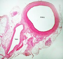 Histological section showing artery and vein