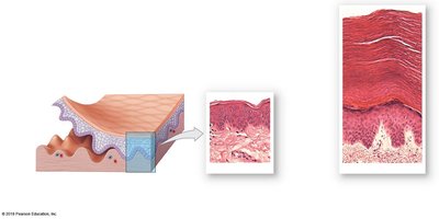 Thin and thick skin comparison