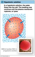 Red blood cell in hypotonic solution