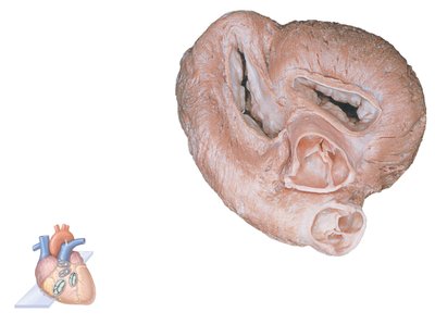 Heart valves: tricuspid, mitral, aortic, and pulmonary